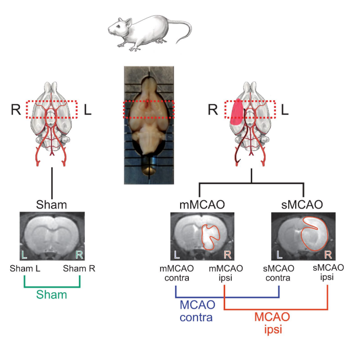 Single nucleus RNA sequencing reveals glial cell type-specific responses to ischemic stroke biorxiv.org/content/10.110…