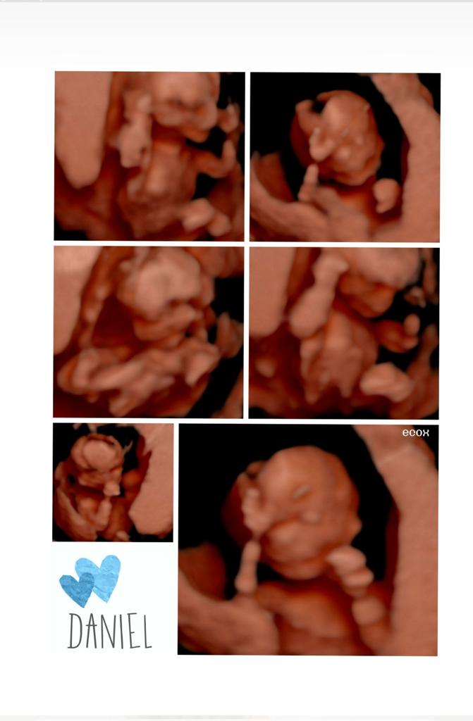 Dani Aranda 14 tweet media