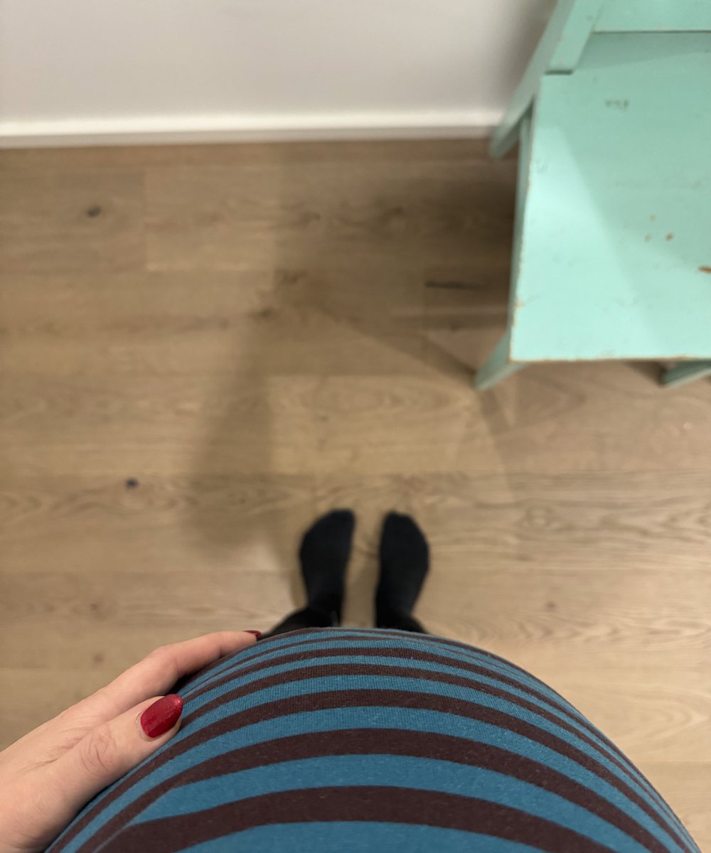 Pikkuisen pahempi joululoman jälkeinen turvotus tänä vuonna. Varpaat sentään vielä näkyy.