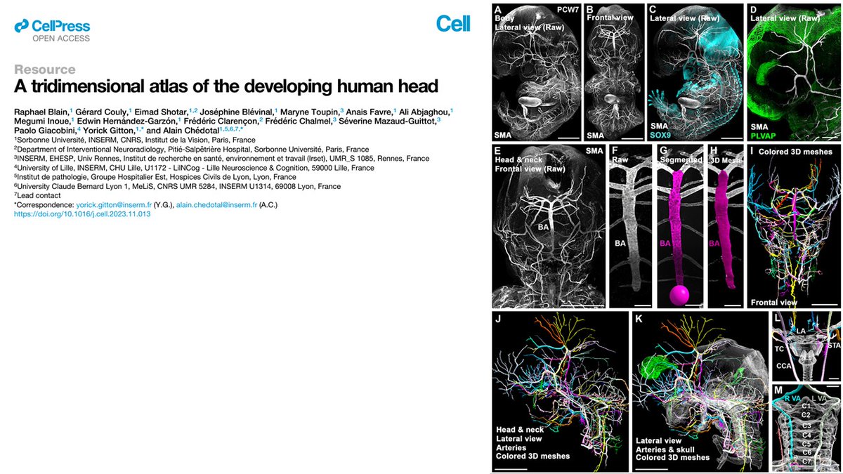 Taka_Tamaso's tweet photo. Amazing study!
This advanced whole-mount immunostaining and 3D imaging techniques can clarify the process of many #anatomical #variants of #cerebral #artery and #vein.

https://t.co/L6GU65fGqD 
#NNAC #FANconference #Neuroangiology https://t.co/8CIPZKVilw