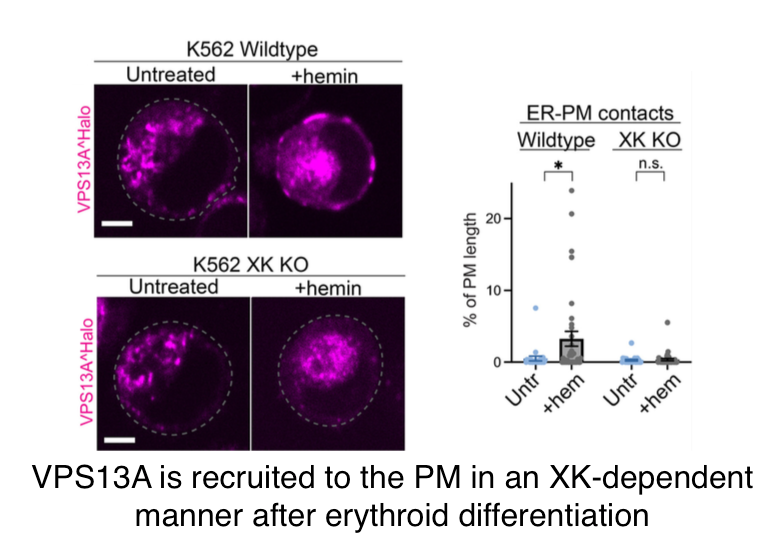 We have new research from the De Camilli group @PDClab replicating the pathophysiology of VPS13A in a disease-relevant cell type journals.sagepub.com/doi/10.1177/25… VPS13A interacts with XK at the plasma membrane of cells after erythroid differentiation @ChaseAmos15 @YaleCellBio @YaleNeuro