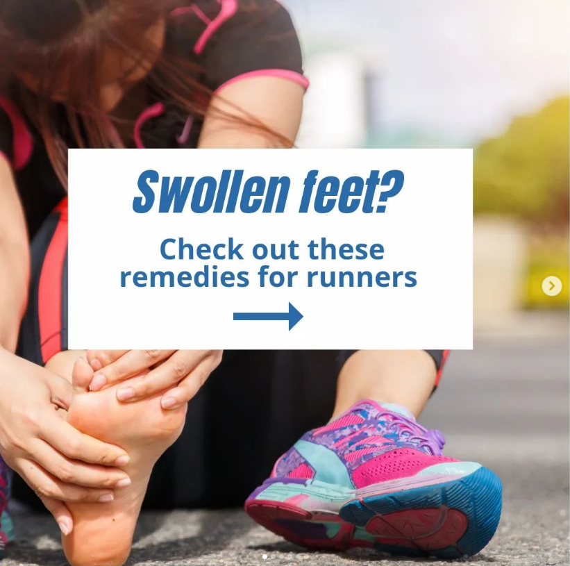 athstrong's tweet photo. Struggling with swollen feet after your runs?
A thread🧵: (1/n) https://t.co/A935DiAxAp