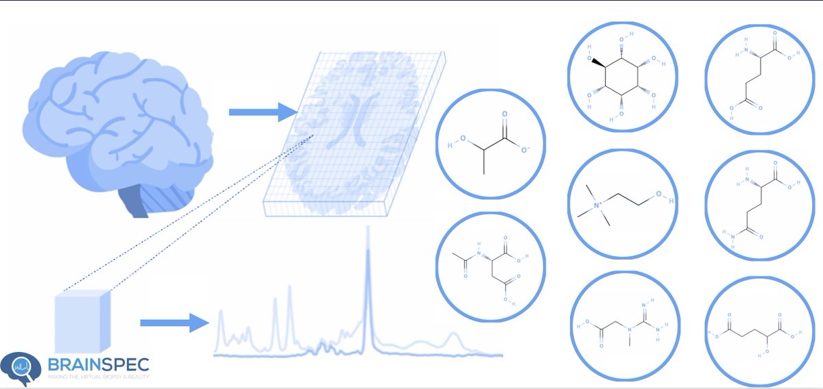 Brain_Spec's tweet image. 🧬🔬 Exciting advancements in MRS for understanding cancer progression! BrainSpec Core™ can provide insights into brain chemistry changes that could revolutionize treatment approach. #CancerAwarness #virtualbiopsy