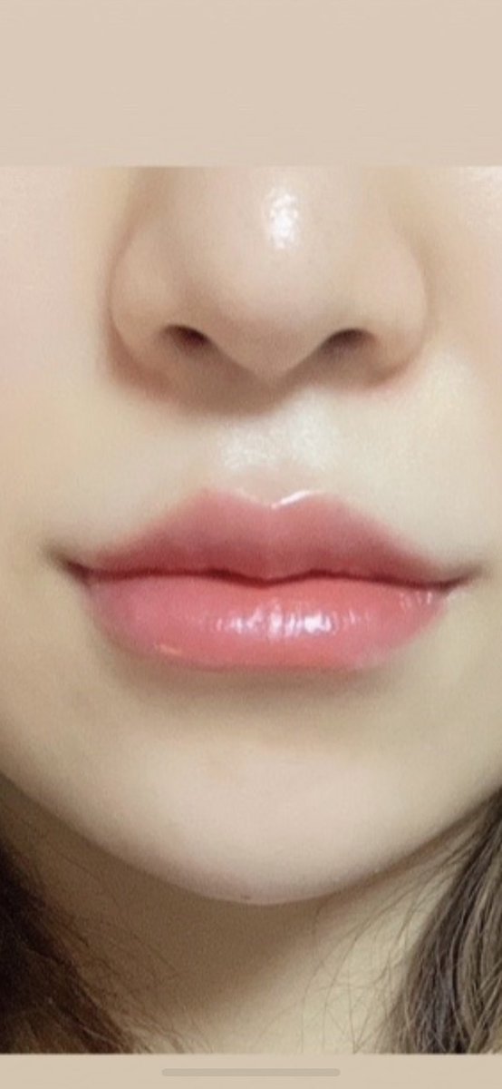 🫧YOURCLINICベンス公式アカウント🫧 tweet media