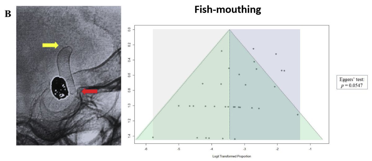 Low rates of fish-mouthing, braid narrowing, collapse + deformation after FD therapy. bit.ly/4aJI9Gm Funnel plot asymmetry suggests asessment method heterogeneity. Standardized definitions for device comparisons upcoming. @SNISinfo @esmintsociety @INR_WFITN @ESNRad
