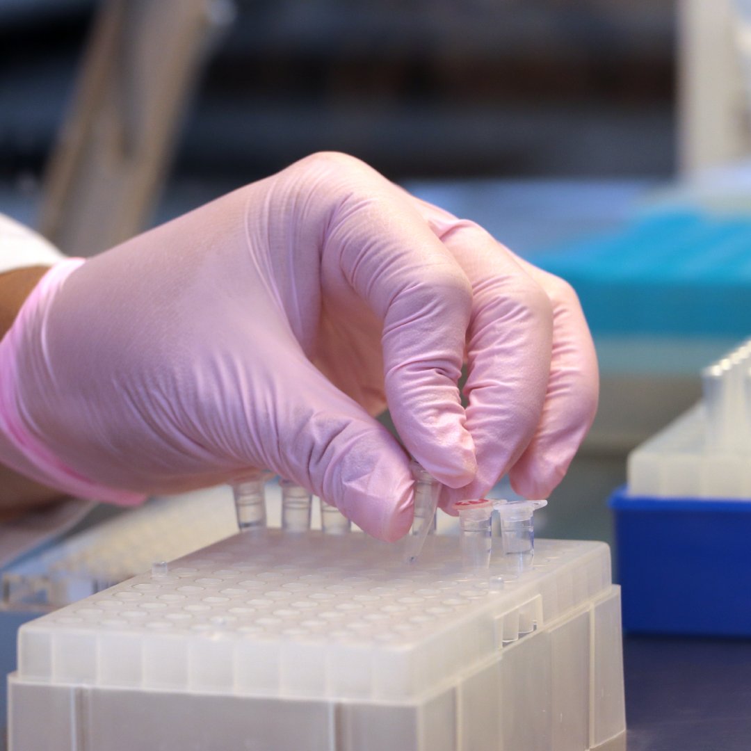 AxionaGenetics's tweet image. En Axiona Genetics contribuimos a crear nuevos horizontes en la lucha contra el cáncer, gracias al diseño de soluciones de diagnóstico innovadoras y mínimamente invasivas para los pacientes oncológicos.

Conozca más sobre nosotros en axionagenetics.com