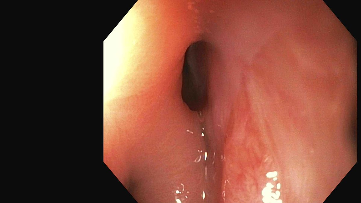 Douglas G. Adler MD, FASGE, FACG, AGAF tweet media