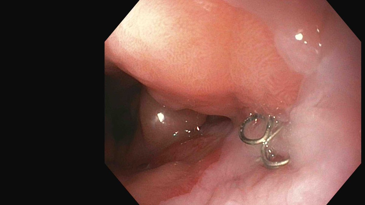 Douglas G. Adler MD, FASGE, FACG, AGAF tweet media