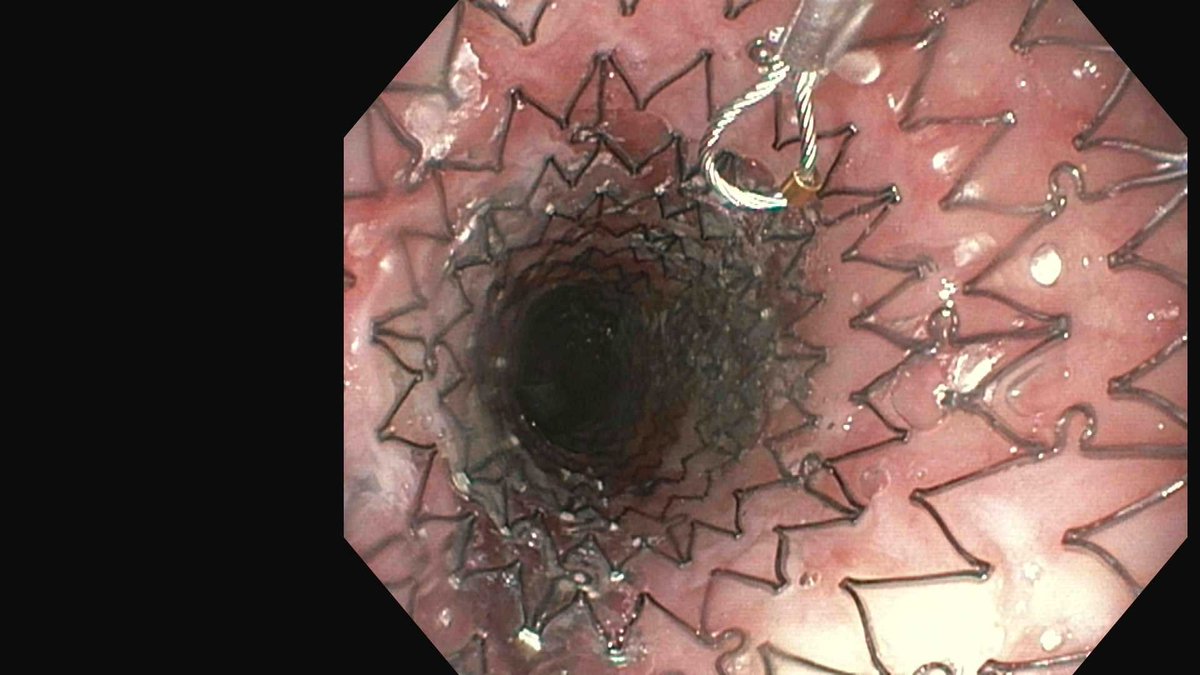 Douglas G. Adler MD, FASGE, FACG, AGAF tweet media