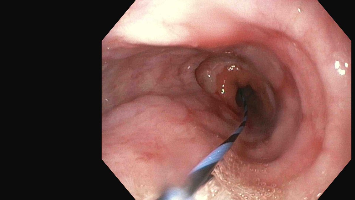 Douglas G. Adler MD, FASGE, FACG, AGAF tweet media