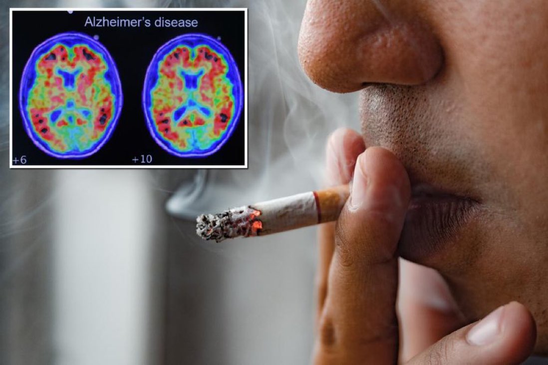 DailyLoud's tweet photo. Smoking cigarettes reportedly leads to brain shrinking and may increase your risk for Alzheimer’s https://t.co/rgXIVBhkyl
