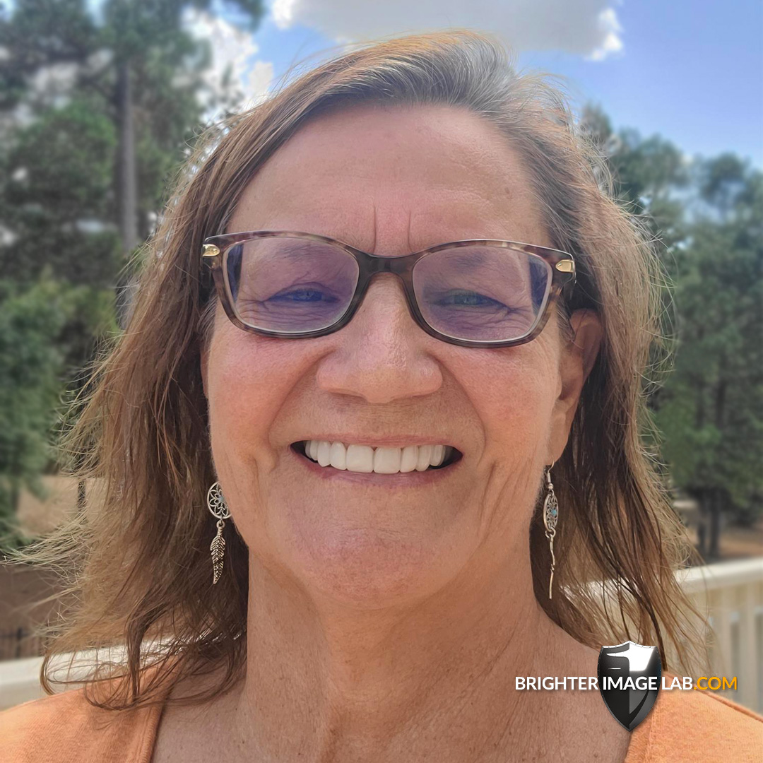 brighterimage01's tweet photo. Zoom in to witness the flawless details of our custom removable veneers! Ready to elevate your smile? Schedule your free smile consultation today to get started!

#smilemakeover #realclient #detail #dentalveneers #veneers #brighterimagelab #bilveneers #smiledesign https://t.co/dYoRmNLb40