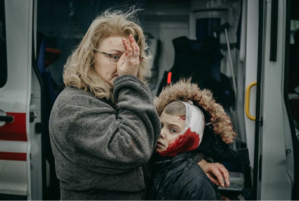 Instead of a thousand words.

Mariana Vlasliuk, 49, holds her son Sasha, 9, wounded by the Russian missile strike on Kharkiv.

📷 wojciechgrzedzinski/Instagram