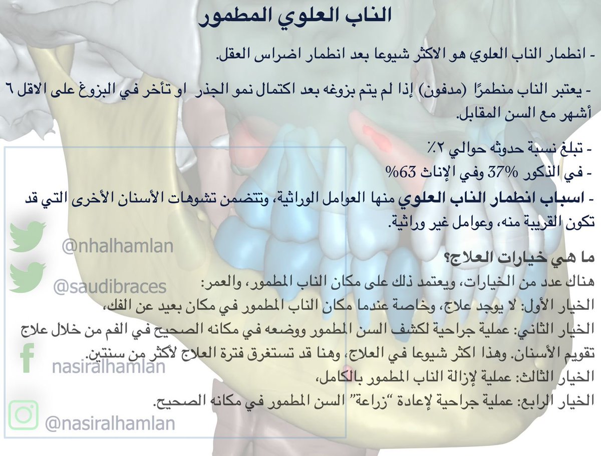 saudibraces's tweet photo. #الناب العلوي المطمور (المدفون)
#تقويم_الأسنان 
#علاج_تقويم_الأسنان https://t.co/CzVyAWaSRR