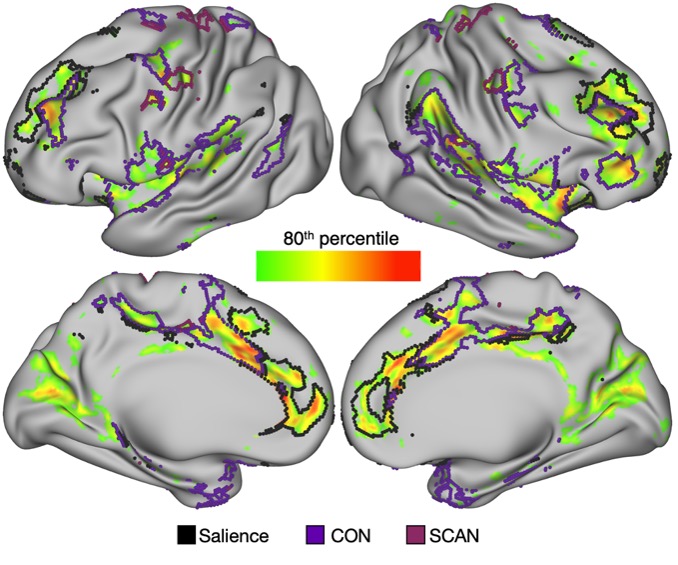 Sam Krimmel (@samkrimmel) on Twitter photo We show that the midbrian red nucleus is functionally connected with the salience network (involved in motivated behavior/reward) and cingulo-opercular network (CON; involved in action control). See preprint here: doi.org/10.1101/2023.1⦠<a href="/DrDamienFair/">Damien Fair</a> <a href="/ndosenbach/">Nico Dosenbach</a> @gordonneuro We show that the midbrian red nucleus is functionally connected with the salience network (involved in motivated behavior/reward) and cingulo-opercular network (CON; involved in action control). See preprint here: doi.org/10.1101/2023.1⦠<a href="/DrDamienFair/">Damien Fair</a> <a href="/ndosenbach/">Nico Dosenbach</a> @gordonneuro