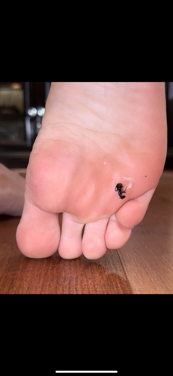 unicornxft's tweet photo. Gott’em! 

#bugcrush https://t.co/M7ljz1Snkn