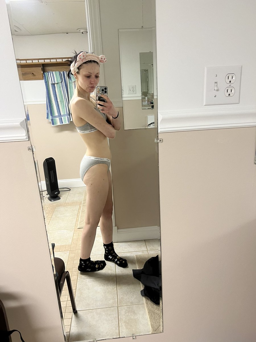 laxativemuncher's tweet photo. this was me 2 wks ago at the end of a relapse cos a girl i used to live with was saying i “got fat” as if me dying of organ failure, malabsorption, malnutrition, dehydration, and laxative abuse wasnt enough + she’d tell me all the time that i was disgusting and not pretty skinny. https://t.co/x3SsN8xe1h