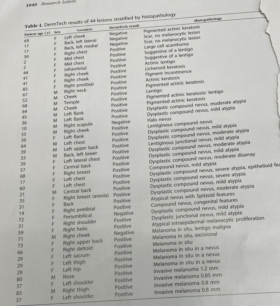 Dr. Jaworsky and colleagues in ⁦<a href="/JAADjournals/">JAAD Journals</a>⁩ - just had a seborrheic keratosis that had a positive DermTech result #dermpath #pathology #dermatology #dermtwitter