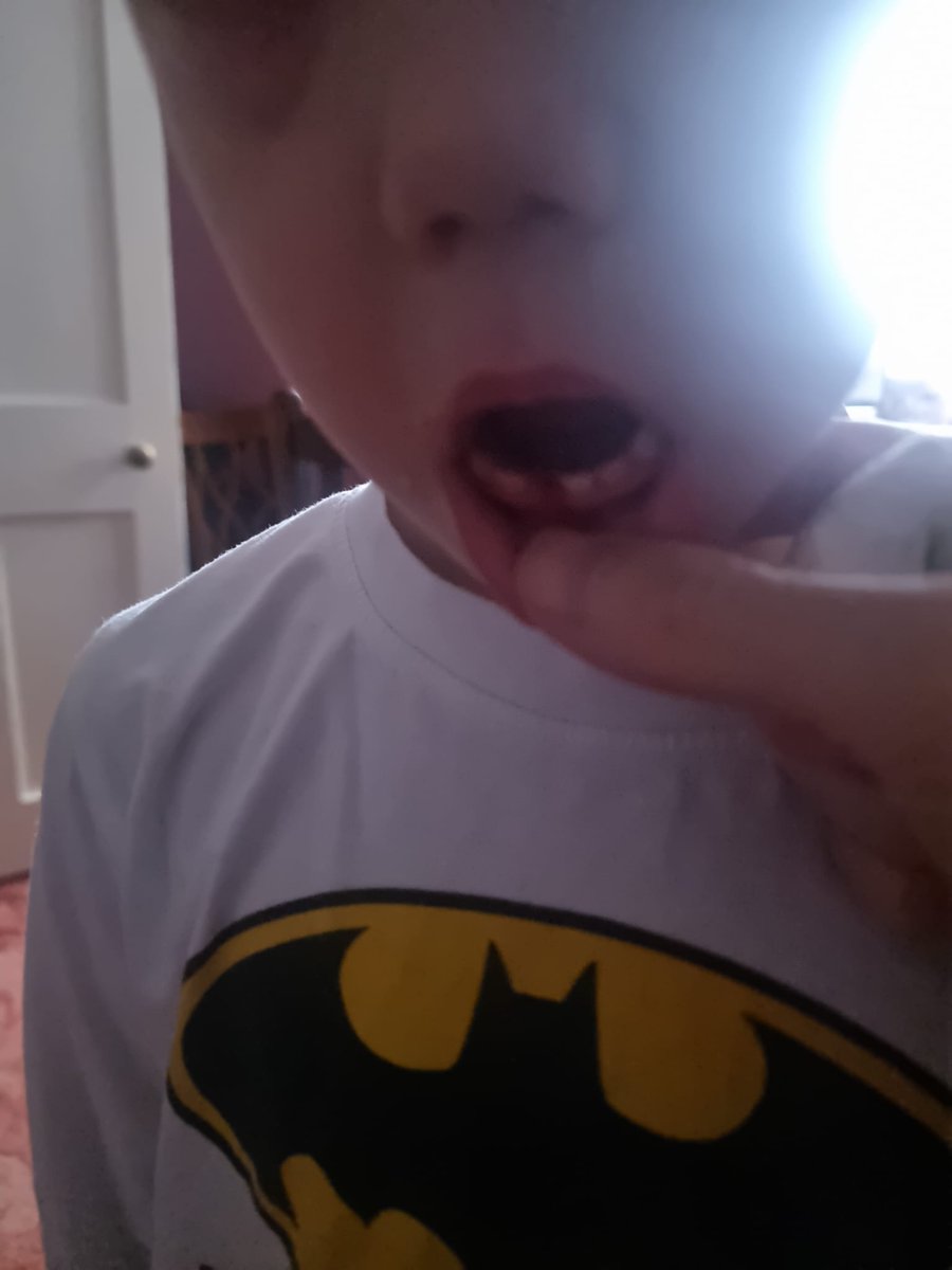 Arlo has lost his 1st tooth today. Taking said tooth to the tooth fairy, he had a little conversation with it 'thankyou tooth for being in my mouth &amp; helping me eat. I'm taking you to the fairy now. Goodbye' I love how his brain works! Such cuteness.