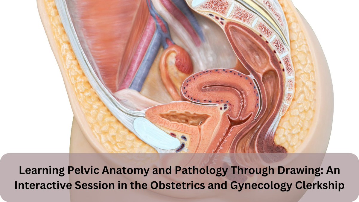 MedEdPORTAL's tweet photo. This interactive session from @WSUBoonshoftSOM @VUMChealth requires OB/GYN clerkship students to draw pelvic anatomy, present their work, & explain topics related to pelvic surgery & pathology to other students. https://t.co/vUyjQlV5c6 #MedEd #MEPFeature https://t.co/cQwYa9X5J2