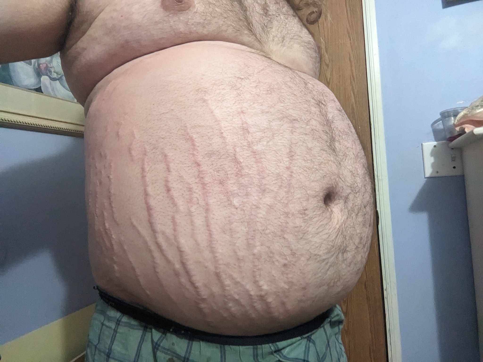 1 pic. Smallish N2O inflation today. Didn't want to push myself. https://t.co/OtnEozlLwr