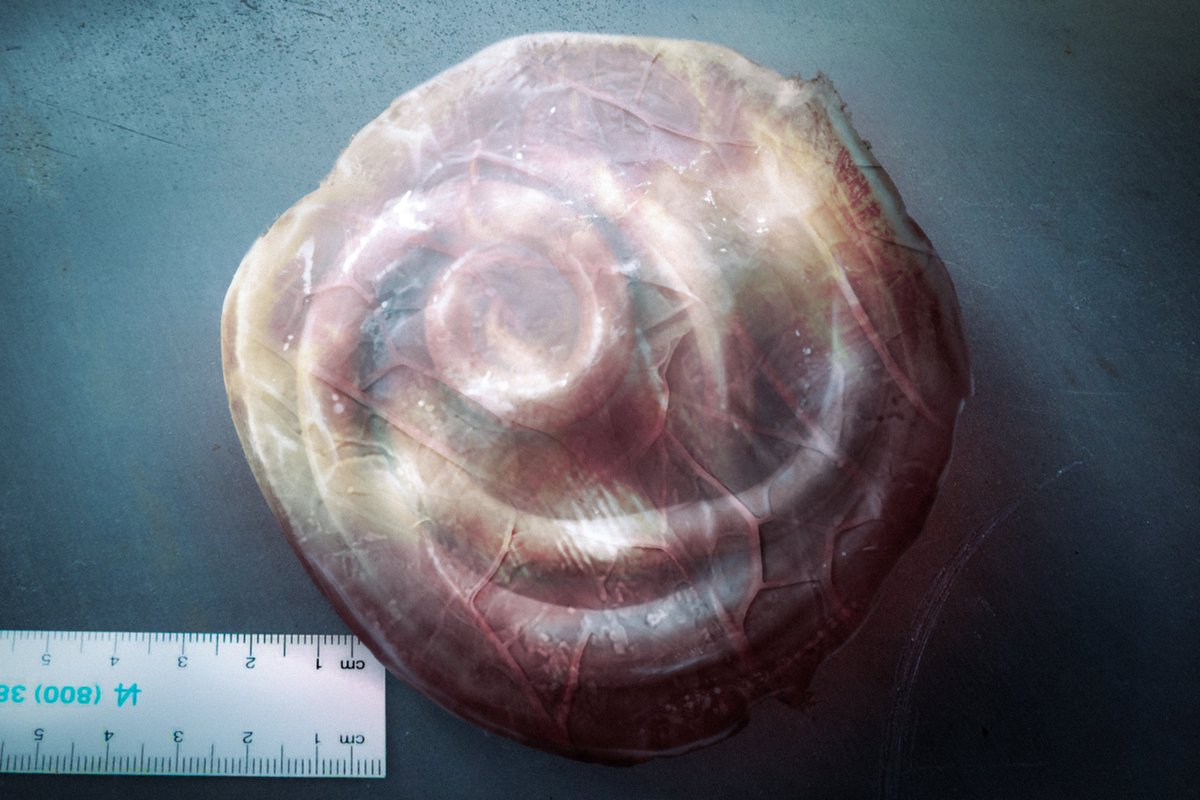 Dracunculus graviditatis is a specialized parasite of the uterus.
Ingested larvae pass the intestine and migrate to the uterine wall, releasing anandamide and hCG analogues. This tricks the body into a false pregnancy state, which the nematode uses to grow to lengths of up to 2m.