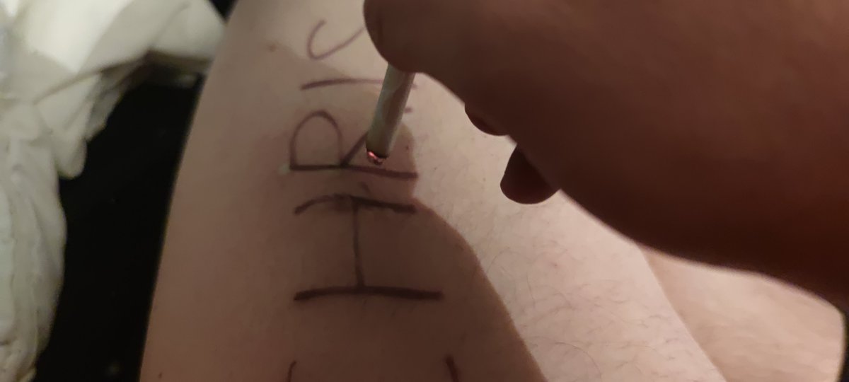 Chrisproperty37's tweet photo. @AlphaCashMatt1 @MxsterChris @MASTER_UPDATES @certifiedalphas @AlphaMaleWorld1 Thank you Master for helping, every reaction means another 15 sec of burning the tattoo https://t.co/QDMAVetT9g