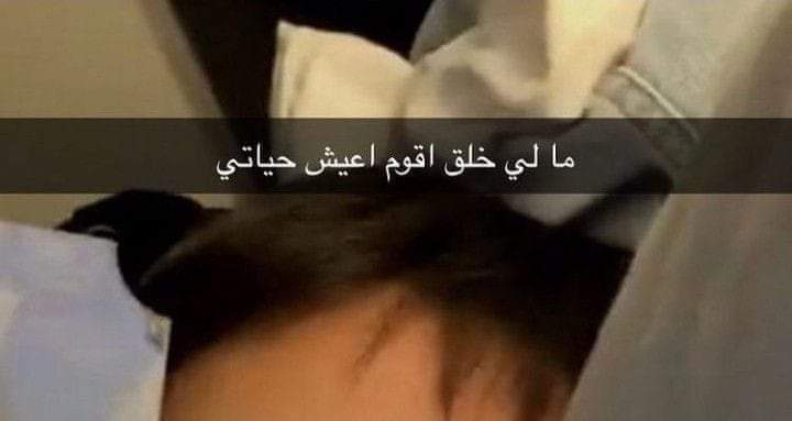 الحالة