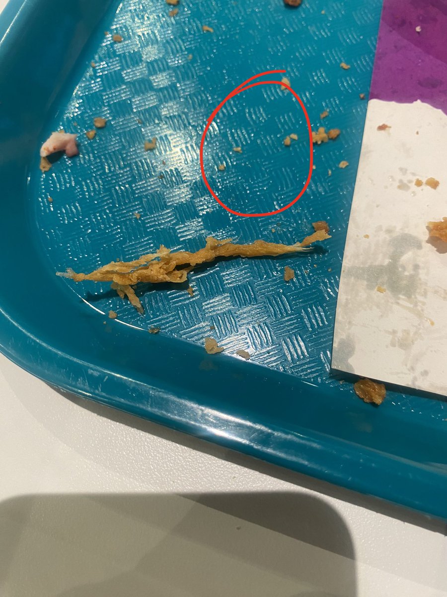 koyaxs's tweet photo. @doingyourmom15 @PopeyesUK @PopeyesUK I am at a loss for words, and I am outraged. In just 1 order I had the displeasure of finding what looks like a worm, a deep fried cumshot, two of my wings engaging in intercourse and one of the workers was just pouring coke on my food. Atrocious. https://t.co/2vNYDjg8bq