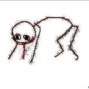 sneepsnorp3d's tweet photo. doctor: “your blood pressure is a little bit high, does coming to the doctor make you anxious?”
me: https://t.co/aLnVR2R3e3