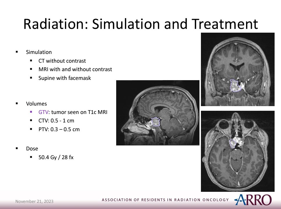 ARRO (@arro_org) on Twitter photo New year 🎆, new updates 📈!!
Check out the updated pituitary adenoma case thanks to <a href="/brynmcmyers/">Bryn Myers, MD</a> <a href="/QatKhanMD/">Qateeb Khan</a> & Dr. Kozak <a href="/IowaRadOnc/">Radiation Oncology</a>
astro.org/ASTRO/media/AS… New year 🎆, new updates 📈!!
Check out the updated pituitary adenoma case thanks to <a href="/brynmcmyers/">Bryn Myers, MD</a> <a href="/QatKhanMD/">Qateeb Khan</a> & Dr. Kozak <a href="/IowaRadOnc/">Radiation Oncology</a>
astro.org/ASTRO/media/AS…