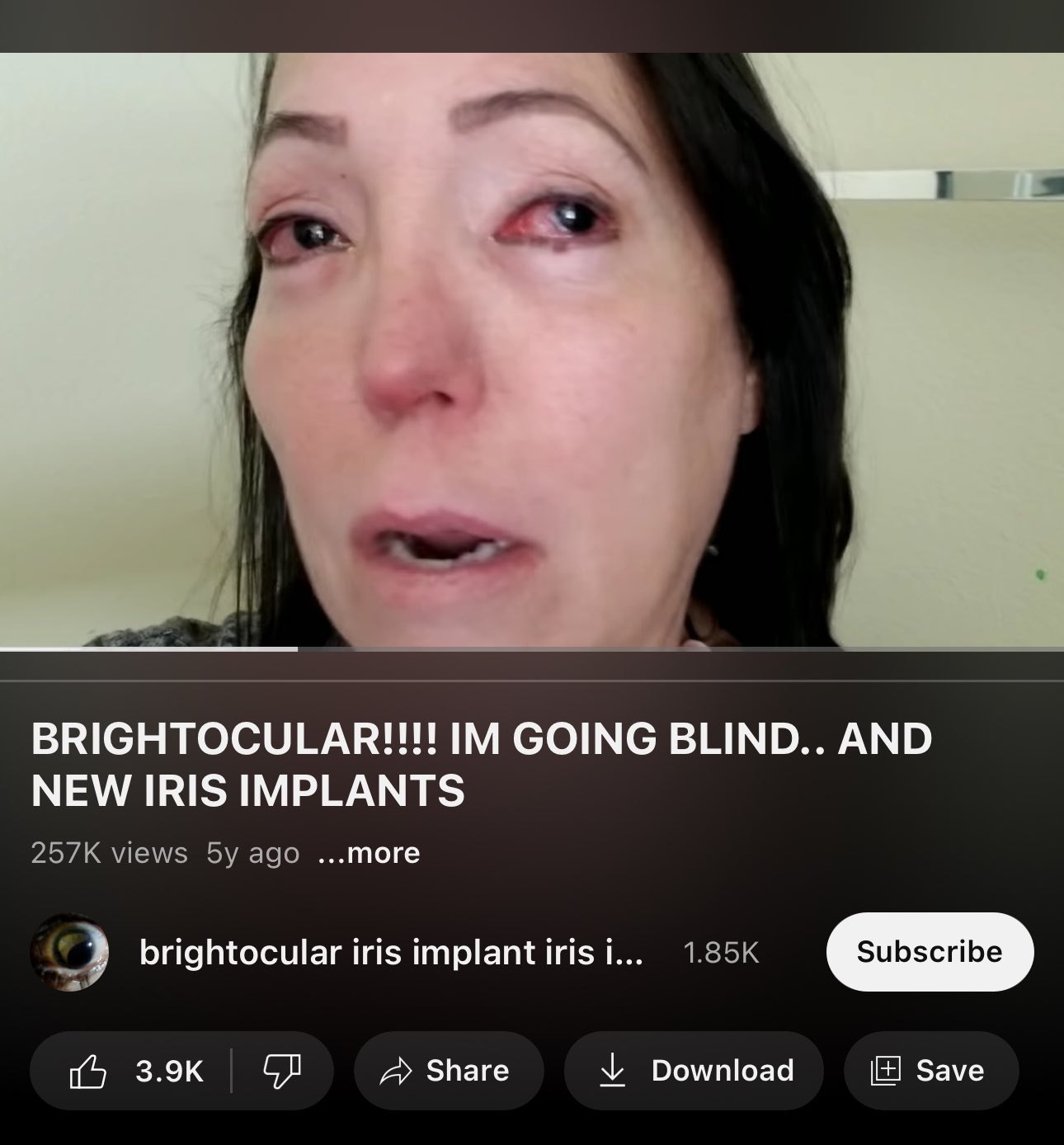 KW on X