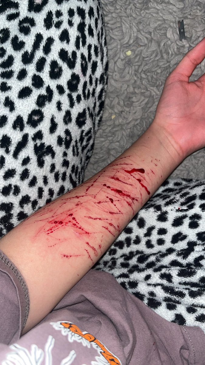 jbxyss0's tweet photo. some pics from today 😔🙏🙏 #shtwt https://t.co/3AozTygVRj