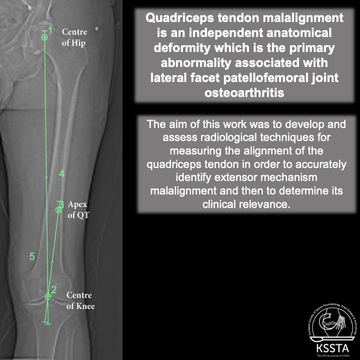 Knee Surgery, Sports Traumatology, Arthroscopy tweet media