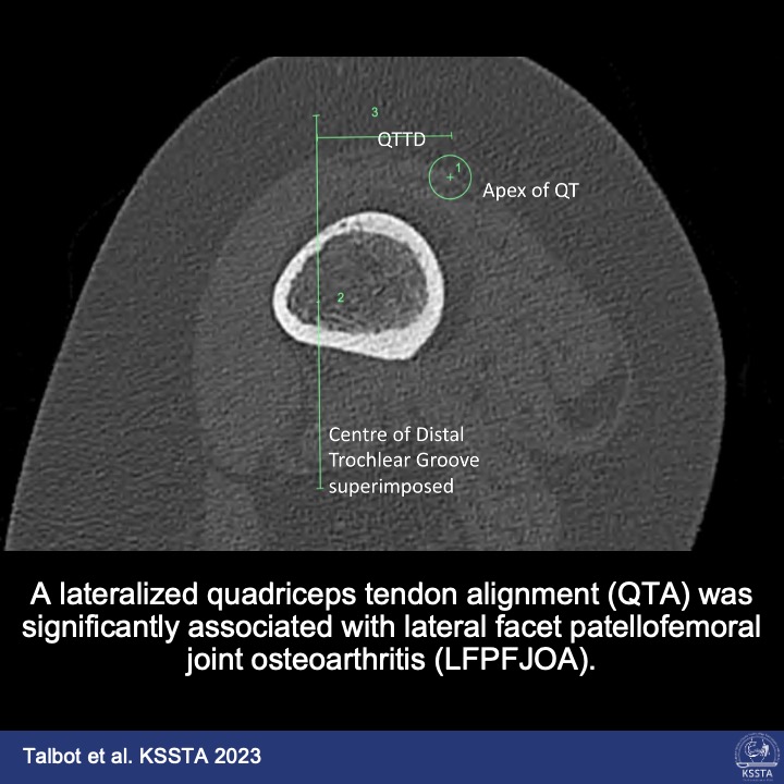 Knee Surgery, Sports Traumatology, Arthroscopy tweet media