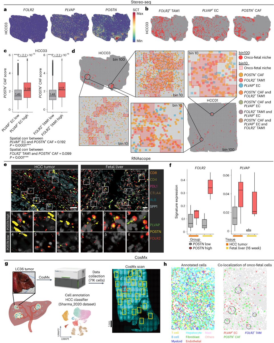 Integrate Stereo-seq's 'true single-cell resolution', scientists delineated specific cell subsets involved in hepatocellular carcinoma (HCC) relapse and response to immunotherapy. Learn more go.nature.com/3NNG9To @asharmaiisc