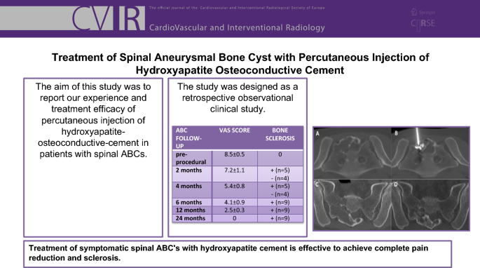#shortcommunication 📞
Treatment of Spinal #Aneurysmal Bone Cyst with #Percutaneous Injection of Hydroxyapatite Osteoconductive Cement
 👉bit.ly/3TLHoqb