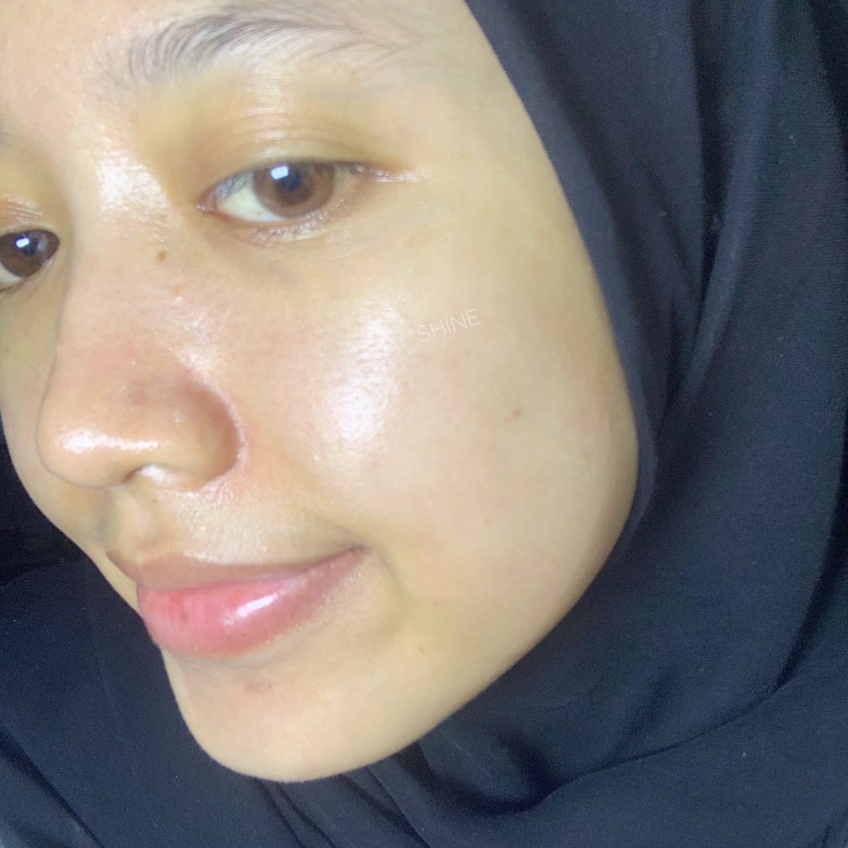 bedazzlingyou's tweet image. In 2023, aku belajar kalo mau cerahin kulit dan mudarin noda hitam bekas jerawat (PIH) bukan cuman fokus ke brightening aja, tapi exfoliasi itu ngebantu bgt 🥹🫶🏻

Udah ada glyvolic acid dan niacinamide, cukup 2-3x seminggu 👌🏻