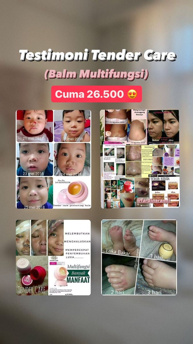 henimujaa's tweet image. Si mungil viral sekarang hadir lagi dengan 3 varian baru lho! ​
🍒 Raspberry, ​
🍏 Green apple​
🤩 Passion fruit​
​
Manfaatnya bantu buat bibir juga kulit keringmu jd terasa lembut, kenyal &amp;amp; ternutrisi. Plus, aroma fruity-nya pasti bikin kamu makin suka
#Tendercare #multifungsi