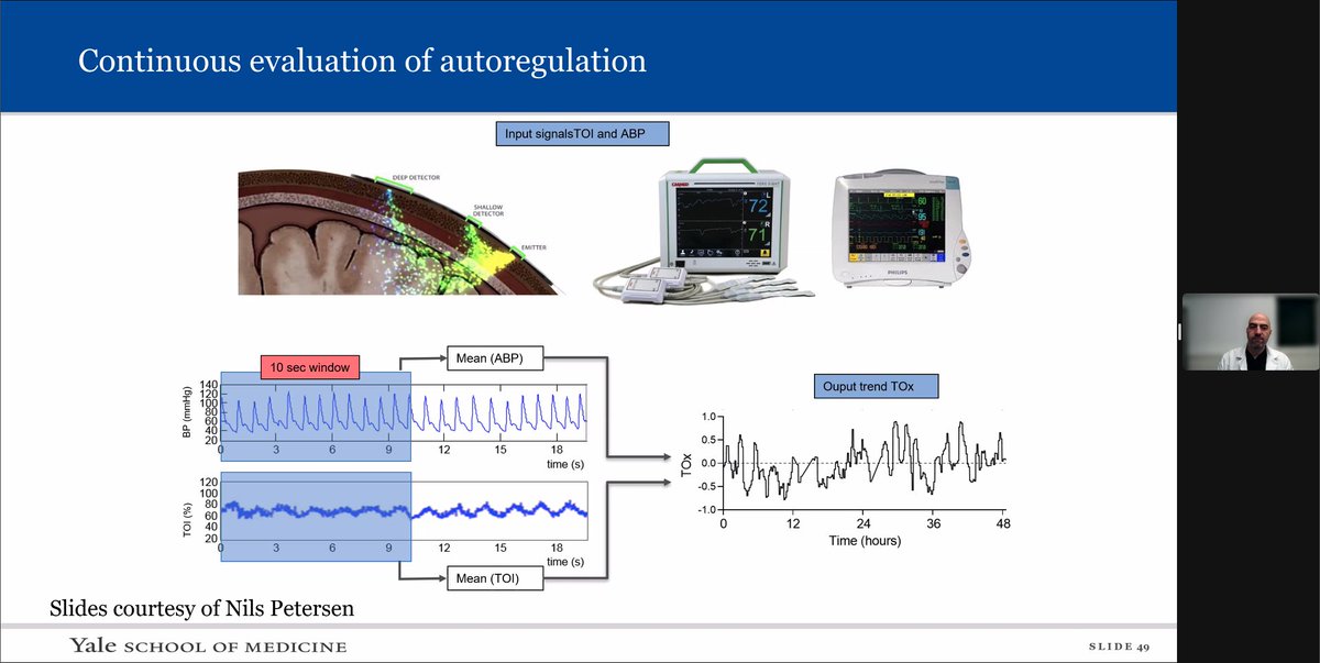 EmoryStroke's tweet photo. Excellent conference by @MoAnadani  delving into blood pressure management post mechanical thrombectomy.  Still an evolving field, with the potential for personalized blood pressure goals shaping the future. https://t.co/2WqWsGz20c