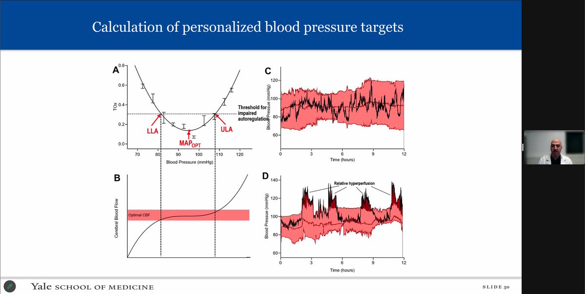 EmoryStroke's tweet photo. Excellent conference by @MoAnadani  delving into blood pressure management post mechanical thrombectomy.  Still an evolving field, with the potential for personalized blood pressure goals shaping the future. https://t.co/2WqWsGz20c