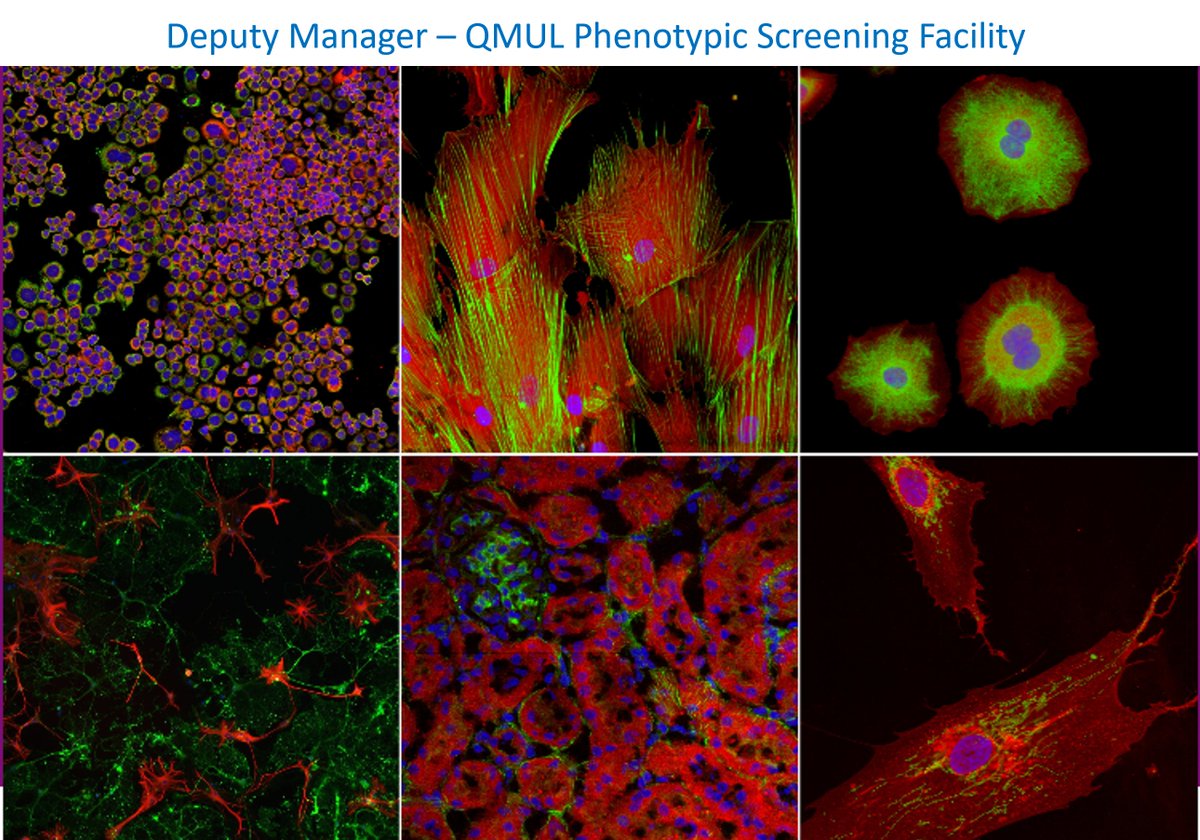 New Year, new job? Excited to be #hiring a Deputy Manager for our Phenotypic Screening Facility #microscopy #multiplex #highcontent #drugdiscovery #screening Excellent training and development opportunity. Interested? Get in touch! Or share! 👉 lnkd.in/ePZy2_V9