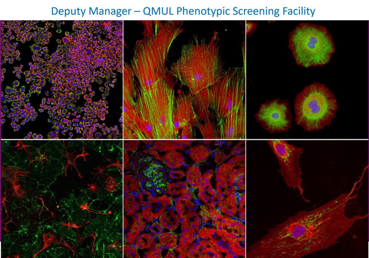 New Year, new job? Excited to be #hiring a Deputy Manager for our Phenotypic Screening Facility #microscopy #multiplex #highcontent #drugdiscovery #screening  Excellent training and development opportunity. Interested? Get in touch! Or share! 👉 lnkd.in/ePZy2_V9
