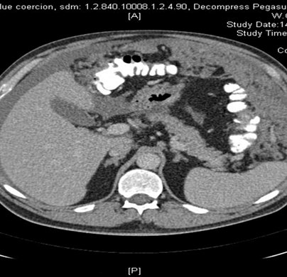 sam_meso's tweet photo. NEW for 2024
The National Peritoneal Mesothelioma MDT is meeting bimonthly on the 1st and 3rd Tuesday of the month.
Our vision is for all Peritoneal Meso patients to be referred early to reduce delays and variability in the care pathway @Mesouk @BasingstokePmi @BTOGORG @PSOGI_EC https://t.co/WdECnNrtuu