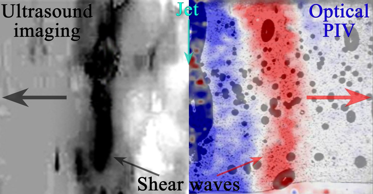 In our last paper, we explore the use of ultrasound imaging to monitor and characterize fast fluid flows, the dissolution of tiny bubbles, and to track the propagation of shear waves induced by "bullet" jets in  gelatin. Read more about it in <a href="/softmatter/">Soft Matter</a>. pubs.rsc.org/en/content/art…