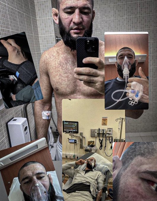 Khamzat Chimaev posted this and since deleted the picture saying he was very sick following his #UFC294 victory over Kamaru Usman 😳