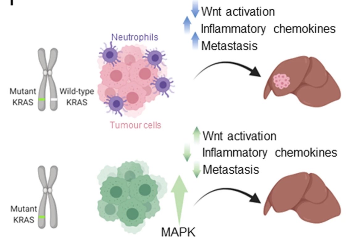 Anirban Maitra (@aiims1742) on Twitter photo New in <a href="/NatureComms/">Nature Communications</a> from <a href="/owen_sansom/">Owen Sansom 🏳️🌈</a> & team <a href="/CRUK_SI/">CRUK Scotland Inst</a>
KRAS allelic imbalance drives tumour initiation yet suppresses metastasis in #ColorectalCancer in vivo
nature.com/articles/s4146…
The status of wild type KRAS is now even more important because of therapeutic ramifications. New in <a href="/NatureComms/">Nature Communications</a> from <a href="/owen_sansom/">Owen Sansom 🏳️🌈</a> & team <a href="/CRUK_SI/">CRUK Scotland Inst</a>
KRAS allelic imbalance drives tumour initiation yet suppresses metastasis in #ColorectalCancer in vivo
nature.com/articles/s4146…
The status of wild type KRAS is now even more important because of therapeutic ramifications.
