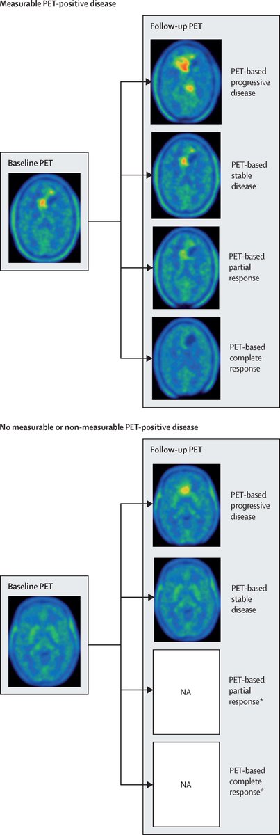 NEW: RANO propose a set of criteria for response assessment based on amino acid PET imaging in clinical trials enrolling participants with diffuse gliomas. thelancet.com/journals/lanon…