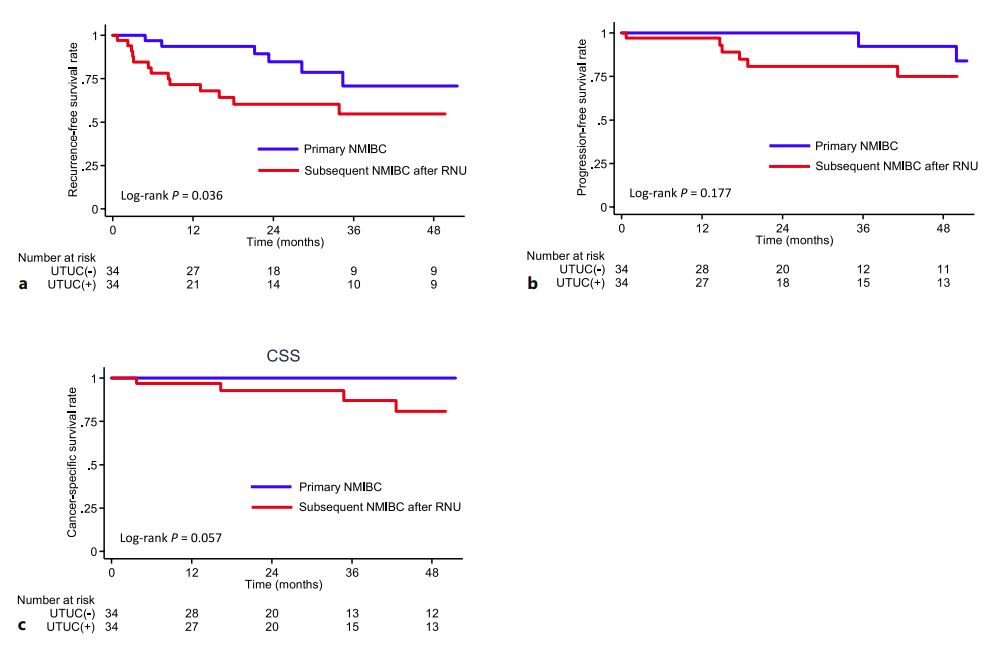 OncoKarger's tweet photo. Patients with Non-Muscle-Invasive #BladderCancer Previously Treated with #Nephroureterectomy Have a High Risk of Recurrence after Bacillus Calmette-Guérin Intravesical Instillation Therapy

➡️ https://t.co/aXkK5Ocw6x
✍️ Maeyama R. et al.
📖 #Chemotherapy

#OpenAcces https://t.co/lf6j1m2oT1