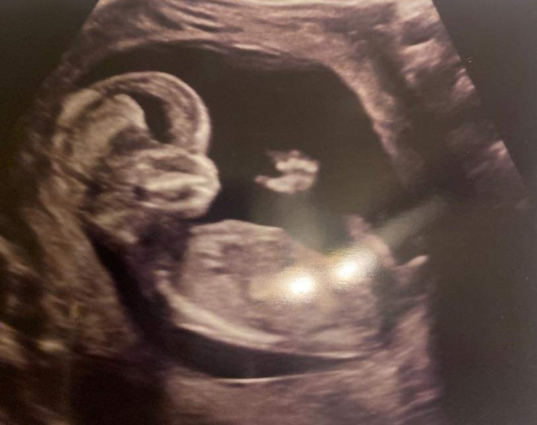 Rolling into the year with a new Face too the Family😁